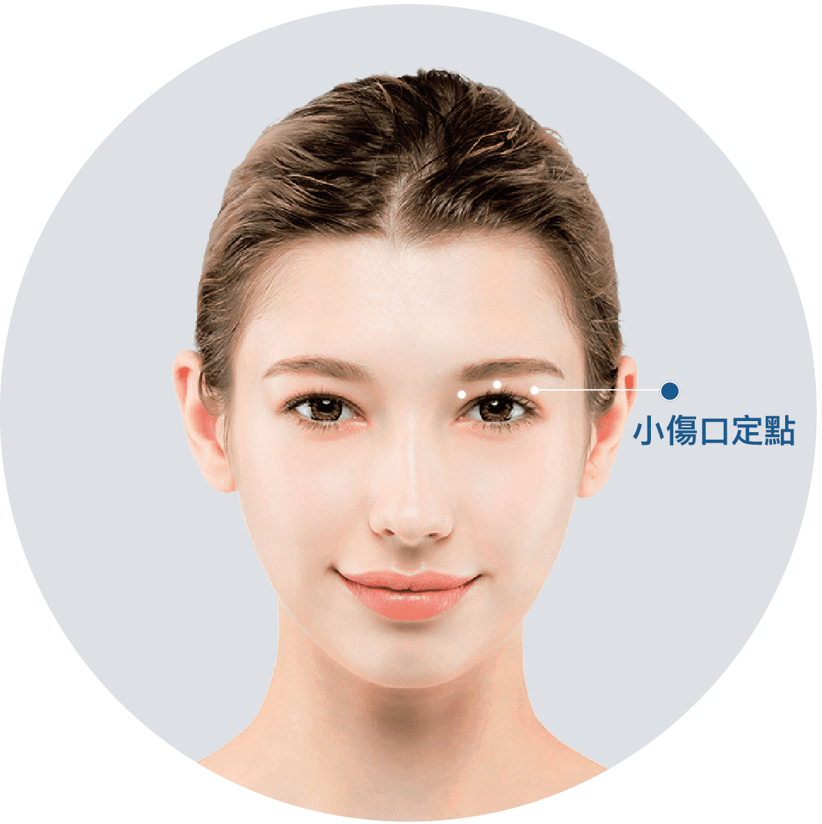 手術位置